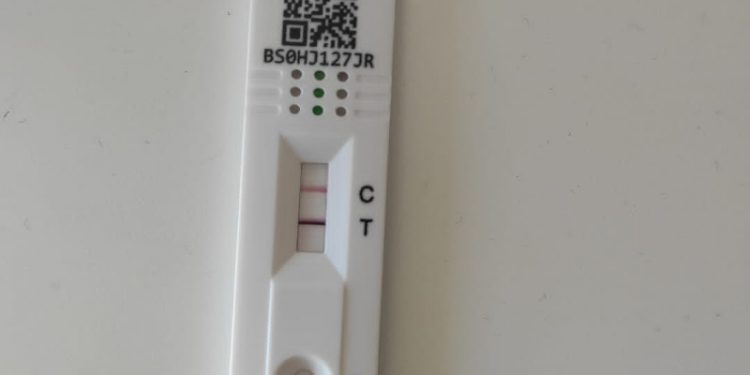 El SAS vuelve a la normalidad: se acabó la valía de los autotest de COVID 1 Imagen de un test de antígenos positivo en COVID-19